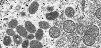Les noms des variants de la variole du singe, jugés « trompeurs » ou « stigmatisants », rebaptisés par l'OMS - Le HuffPost