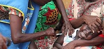 Measles outbreak kills 80 children in Zimbabwe - Global Times