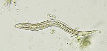 Why do my kids keep getting worms? And is that what is making them so cranky? - Medical Xpress