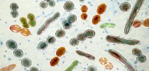 Which microbes live in your gut? A microbiologist tries at-home test kits to see what they reveal about the microbiome - The Conversation