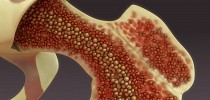 What is the long-term durability of plasma cells in human bone marrow? - News-Medical.Net