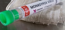 WHO asks public for help with monkeypox name change - Al Jazeera English
