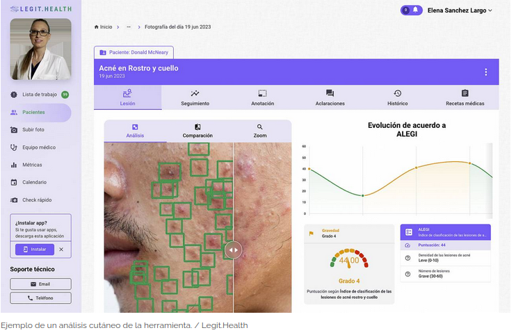 Aplicación móvil con IA ayuda a evaluar patologías cutáneas